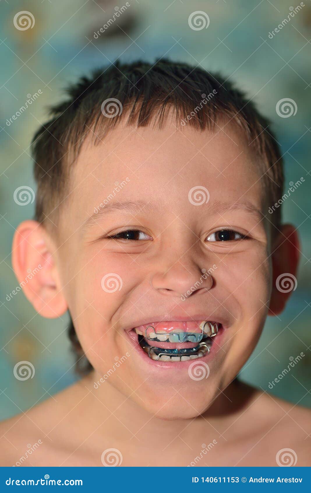 черные зубы картинки
